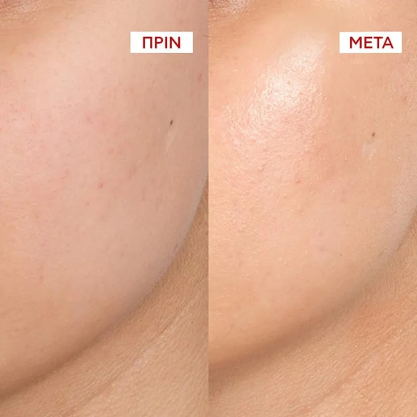 3337875945851-Vichy-Liftactiv-Collagen-Specialist-16-Collagel-Glow_Boosting-Gel-Τζελ-Αναζωογόνησης-για-Λάμψη-&-Ενίσχυση-του-Κολλαγόνου-50ml-olgaspharmacy